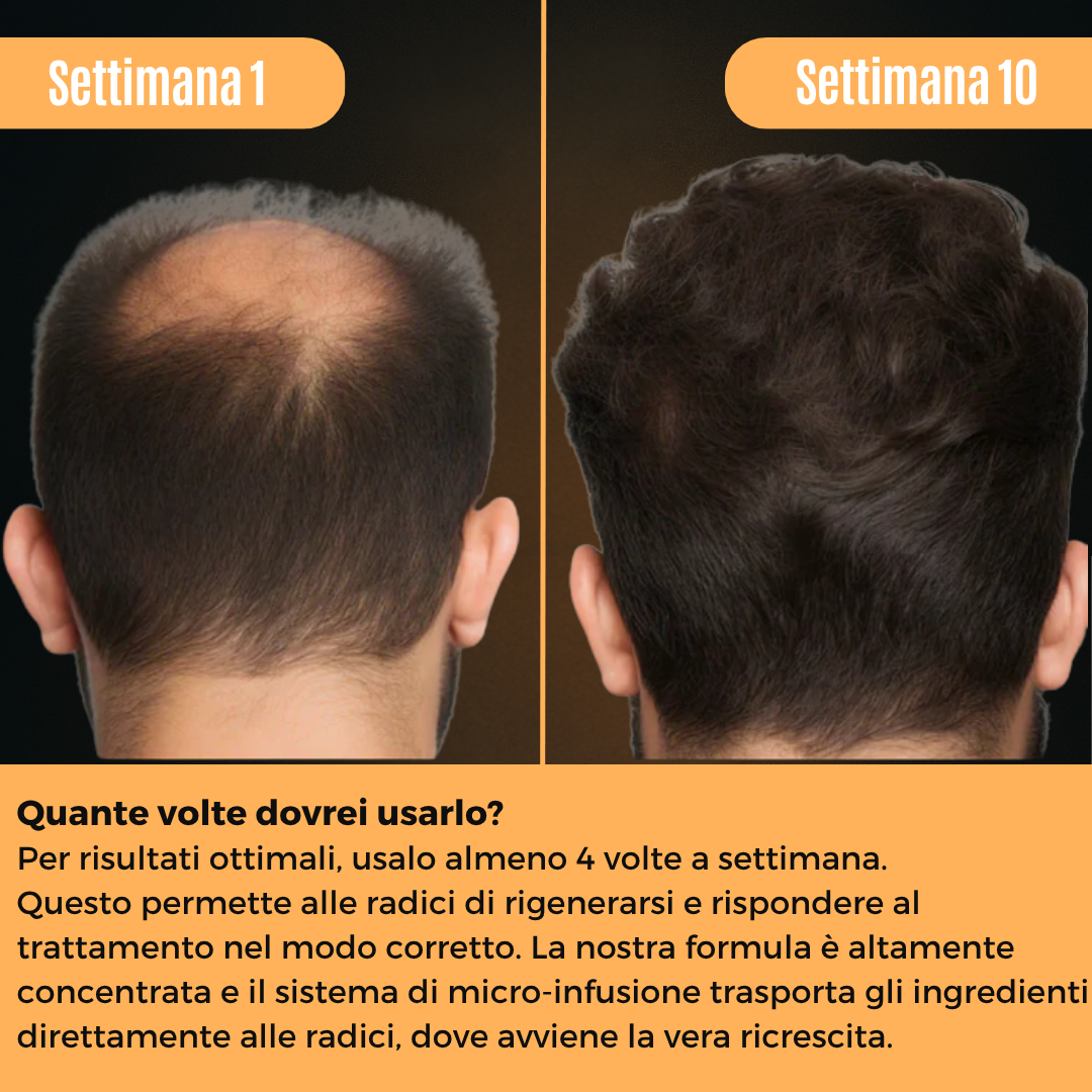 Shampoo Riparatore DensoBoost  – Ricrescita Visibile in 6 Settimane Senza Farmaci