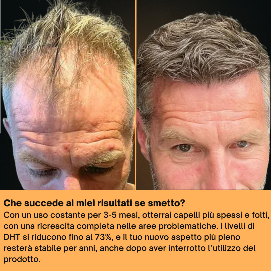 Shampoo Riparatore DensoBoost  – Ricrescita Visibile in 6 Settimane Senza Farmaci