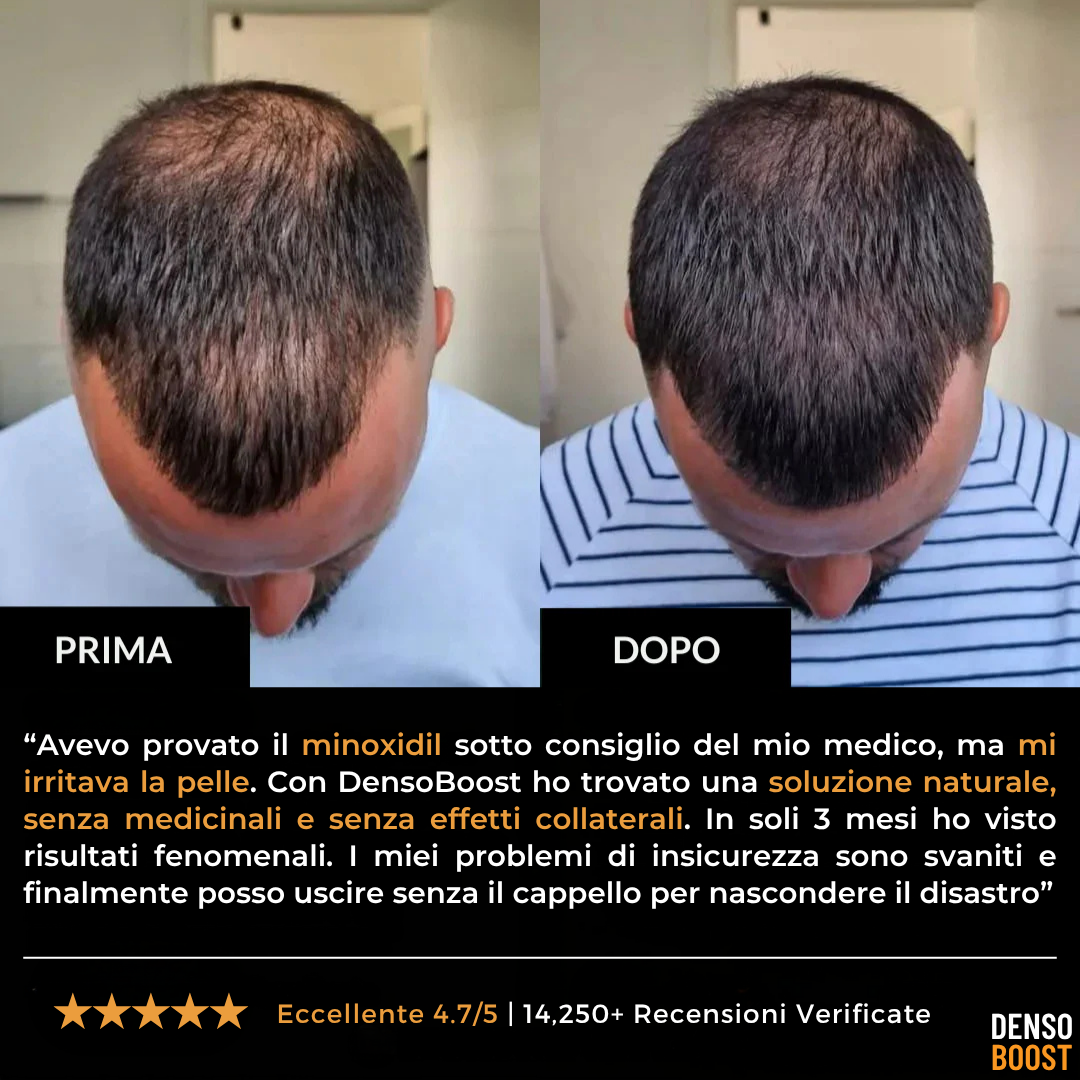 Shampoo Riparatore DensoBoost  – Ricrescita Visibile in 6 Settimane Senza Trapianto